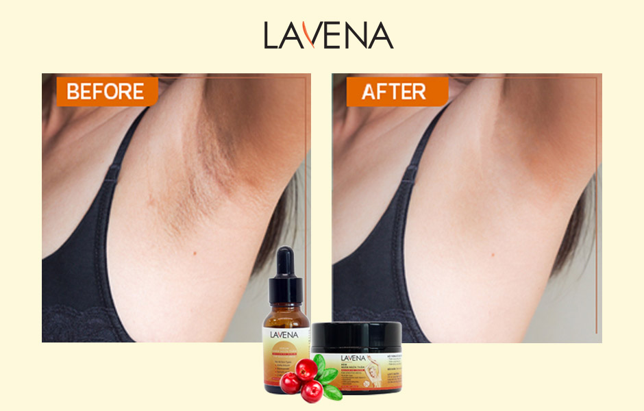 Trước và sau khi sử dụng kết hợp kem và serum Lavena